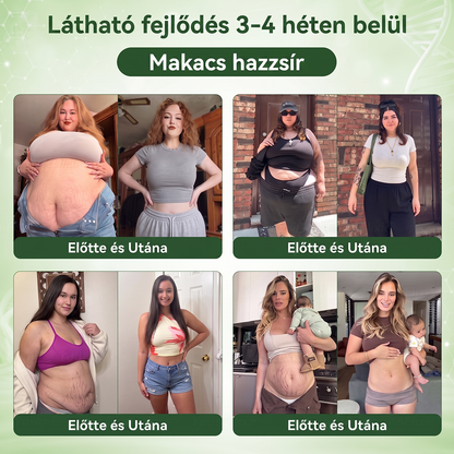 ANGELTRAP®🎃 köldökcseppek – Fejlett transzdermális metabolikus cseppek